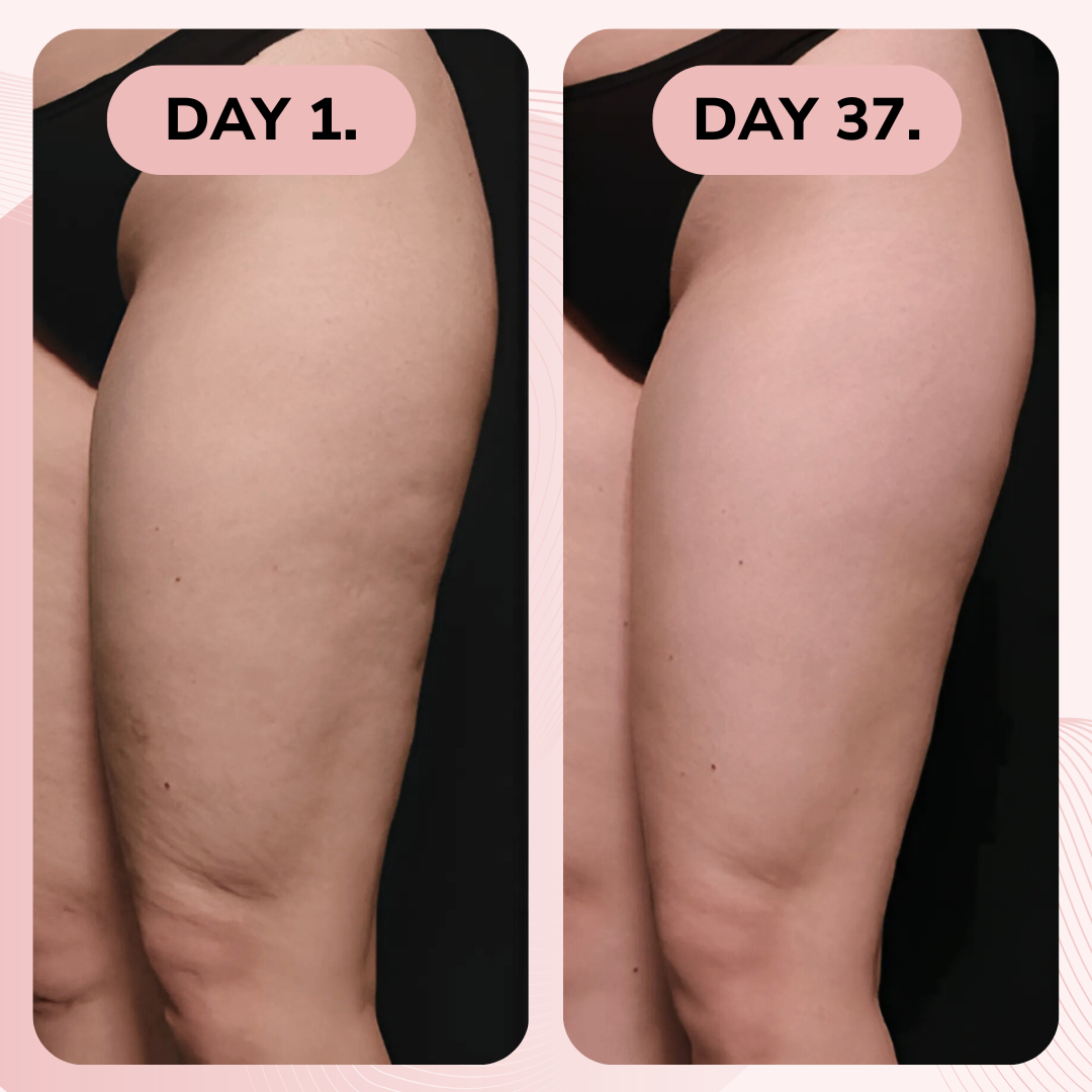 VeluxeCare™ Body Contour