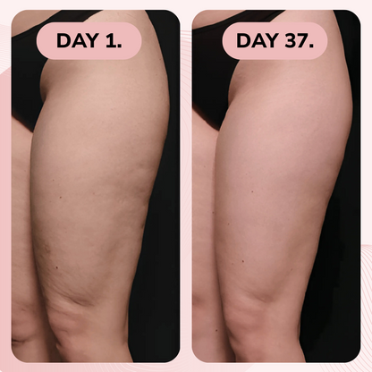 VeluxeCare™ Body Contour